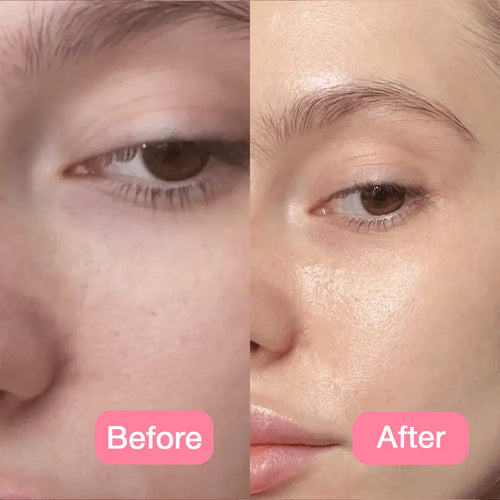 Suskin Jelly Cream